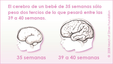 Si su bebé nace antes de las 39 semanas, ¿se afecta su desarrollo? Si su bebé nace antes de las 39 semanas, ¿se afecta su desarrollo?