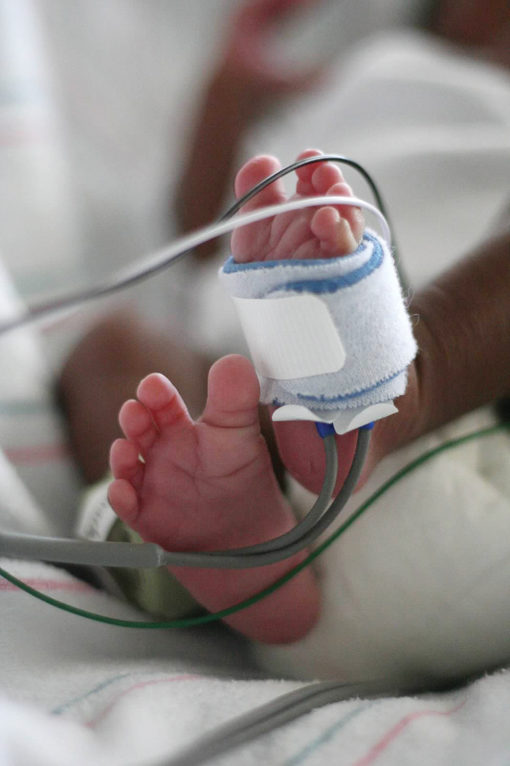 Cómo se detectan las condiciones del corazón en los bebés Cómo se detectan las condiciones del corazón en los bebés