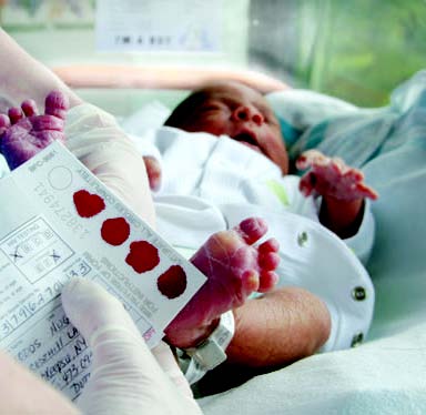 Las primeras pruebas de su su bebés: Pruebas de detección para recién nacidos